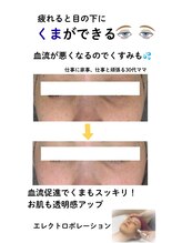 ダーウィン(Darwin)/寝てもとれない目の下のくま