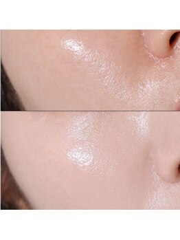 ビューティーサロン ハル(Beauty Salon ha_ru)/全顔ワックス美顔ライト