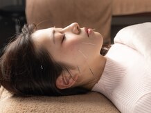 ハリヤベース鍼灸整骨院(HaRiYa BaSe鍼灸整骨院)