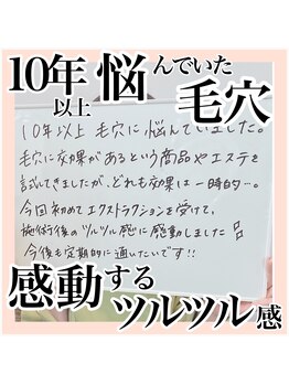 ルネッタ(Lunetta)/