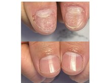 こだわりのネイルケアで爪も育ちます