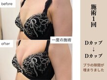 ソワ(soie)/思わず触りたくなるデコルテ