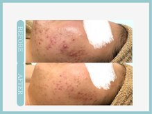 スリムライン 八戸店(The Slim Line)/before→after