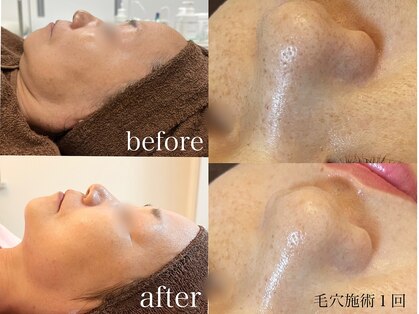 カノネ(Cannone')の写真