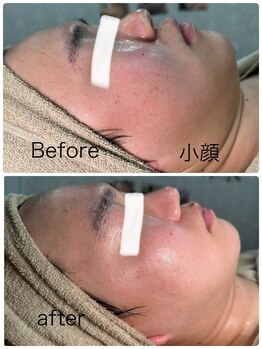 ルミネル 名古屋新栄(Luminelle)/頭蓋骨矯正