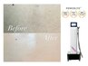 夏に向けて自分ではケアできない背中を徹底脱毛【背中脱毛体験】