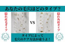 サロンド ケイティ(Salon de Katy)の雰囲気（毛穴ケアマスターエステティシャンがいるサロン！毛穴洗浄/毛穴）