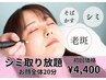 【人気NO.2】シミケアし放題【夏でもできる】顔全体20分4400(三島)