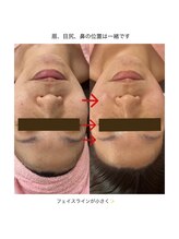 ブーケ(bouquet)/フェイスラインだけ小さい