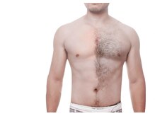 サロン リノ(Salon Lino)/男性脱毛