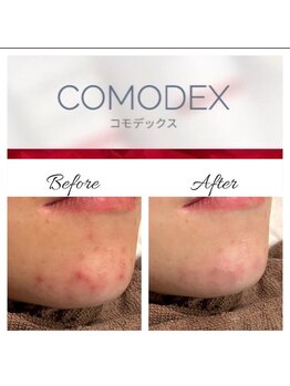 トータルビューティーサロン ルース(LUZ)/コモデックス