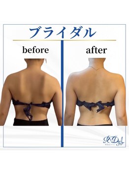 デール(R:DeeL)/ドレスを着こなす背中