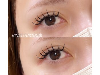 ビュー(V.I.E.W)/BIND LOCK100束