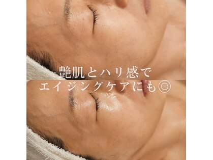 エメ(Aimer)の写真