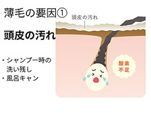 サロン ド エステティック ルチア 東京店/頭皮の汚れ