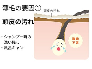 サロン ド エステティック ルチア 東京店/頭皮の汚れ
