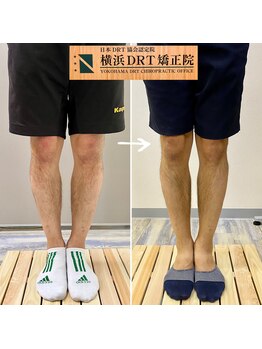 横浜DRT矯正院/O脚矯正