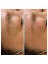 爪屋べっぴん堂/アイブロウマッピング