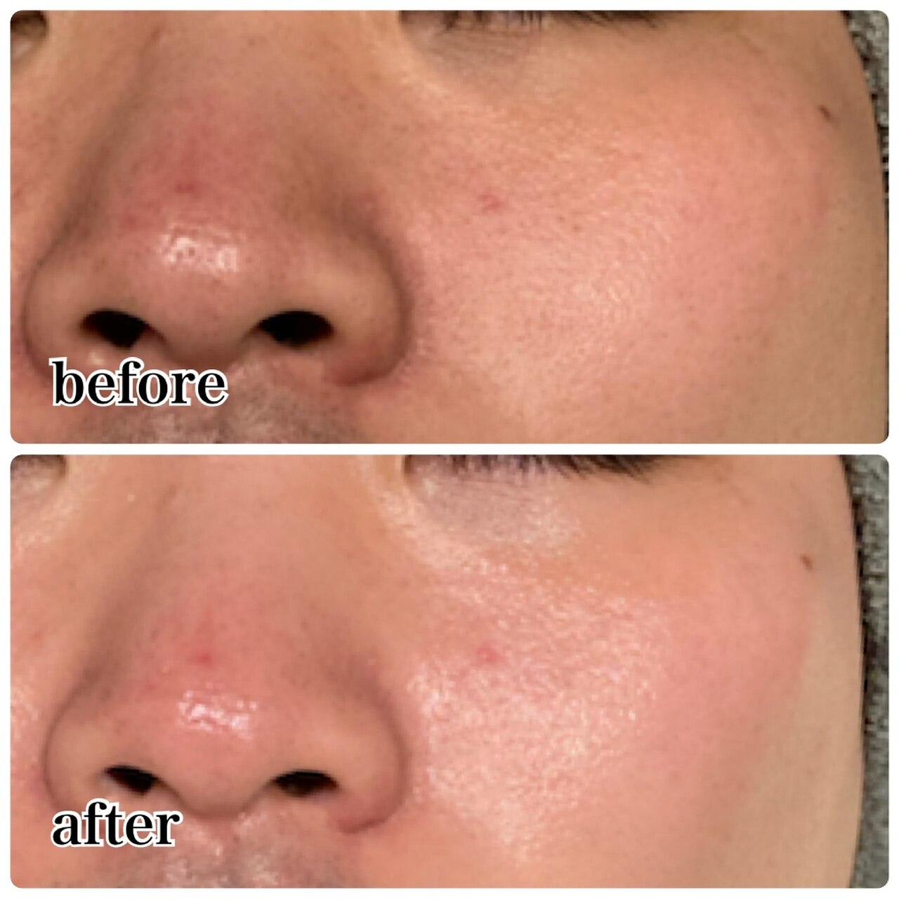 肌質改善エステサロン♡ 美成(vise)｜ホットペッパービューティー