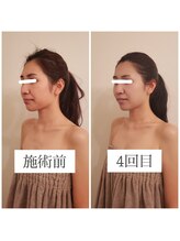 エクラ(eclat)/お客様の変化