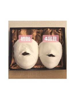 小顔コルギサロン シー(She)/石膏パックの変化！