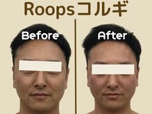 ループス(Roops)の雰囲気（メンズのお客様も多くいらっしゃいます【小顔/コルギ】）