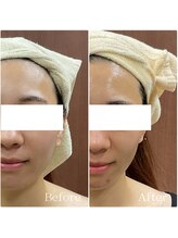 メイス 福井店(MEIS)/お客様Before、After