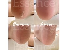 エッセンス (Essence)の雰囲気（深爪改善,美爪育成,手肌美容,足爪補正,足裏ケア‥ご相談ください）