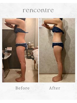 ランコント(rencontre)/肩こり/リンパ/ヘッドスパ/痩身