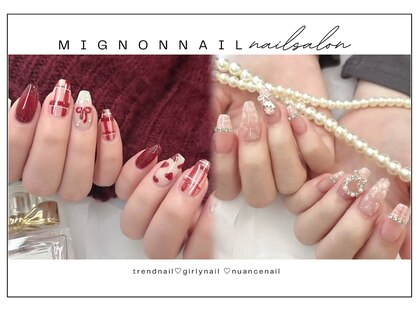 ミニョンネイル(mignon nail)の写真