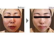 全国エステダーマコンテストでグランプリを受賞しました！！