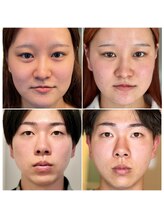 ウンジョルノ フェリーチェ 表参道店/えらにもアプローチ！