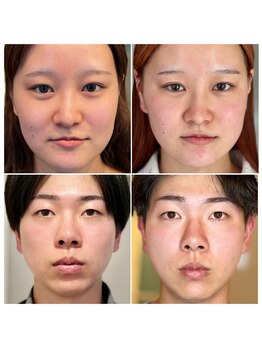 ウンジョルノ フェリーチェ 表参道店/えらにもアプローチ!