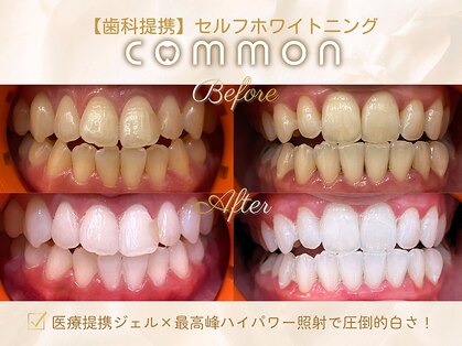 セルフホワイトニングコモン 藤枝店(self whitening common)の写真