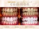 セルフホワイトニングコモン 藤枝店(self whitening common)の写真