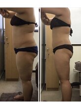 ビューティーワークスシャンティ 柏店(Beauty Works Shanti)/6ヶ月でー9.8kg！！2枚目