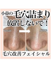 ルネッタ(Lunetta)/