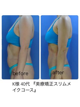 エステージ(estage)/