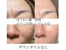 【プロセルフェイシャル】深いシワケアや凸凹肌　50000円→41000円
