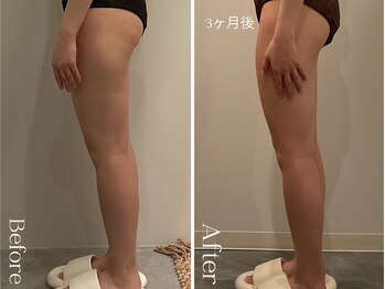 ユーフォリア グロウ(euphoria glow)/{ ラフォス痩身90分 10回 }