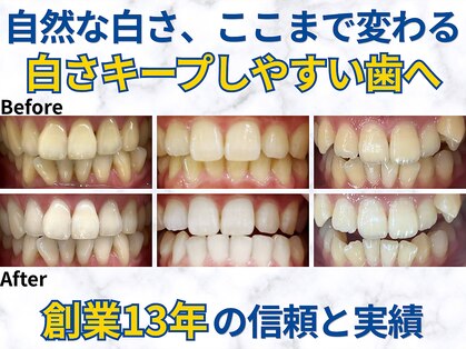 LBSホワイトニング 梅田店の写真