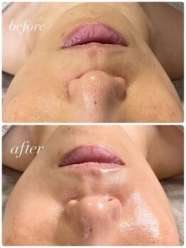 エユージュ(eyuge)/