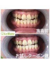 ルブラン 奈良店(Le Blanc)/効果に自信あります！！