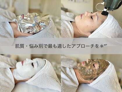 リリアス(RILLIAS)の写真