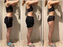 インプルーブ 浜北店(Improve)/お腹周り-12ｃｍ！　20代女性