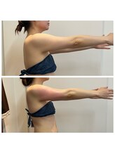 セレア(CELEA)/二の腕/ブライダル/二の腕細く