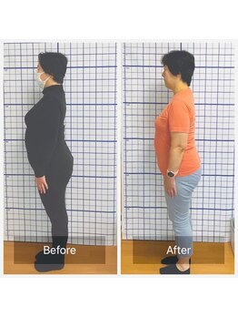 幸鍼灸整体院 武庫之荘院/整体・トレーニング・姿勢変化11