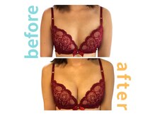 シエル(Ciel)/バストアップ施術１回