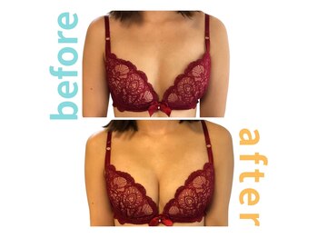 シエル(Ciel)/バストアップ施術１回