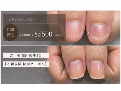 アネラ(Anela)の写真